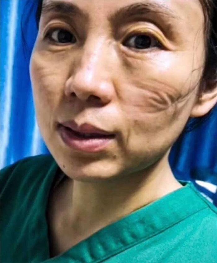 武汉疫情再次爆发，挑战与希望并存