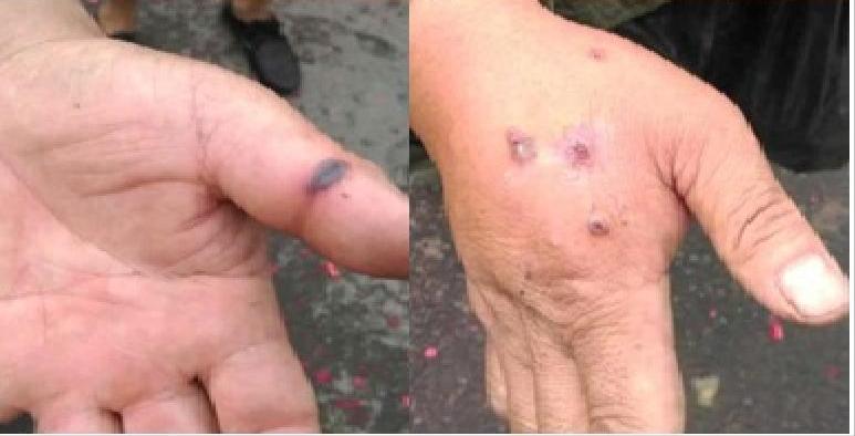 北京疫情封闭管控，回顾与反思